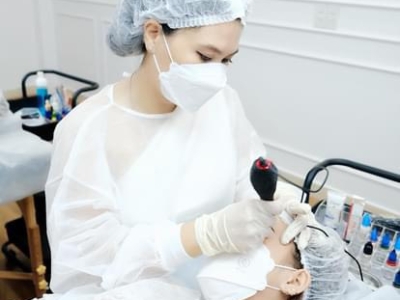 BẮN NỐT RUỒI - TÀN NHANG MẶT